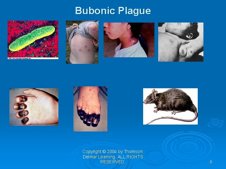 Bubonic Plague Copyright © 2004 by Thomsom Delmar Learning. ALL RIGHTS RESERVED. 6 