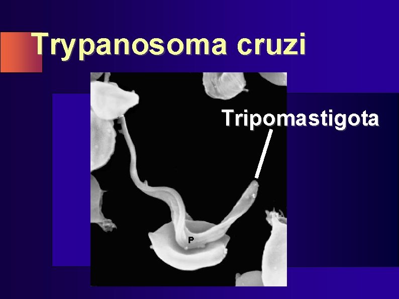 Trypanosoma cruzi Tripomastigota 