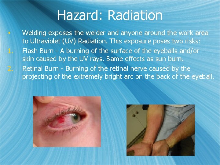 Hazard: Radiation s 1. 2. Welding exposes the welder and anyone around the work