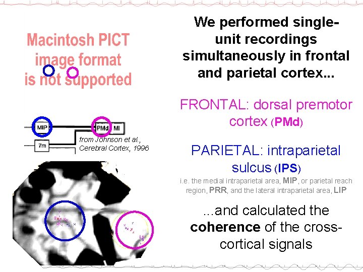 We performed singleunit recordings simultaneously in frontal and parietal cortex. . . FRONTAL: dorsal