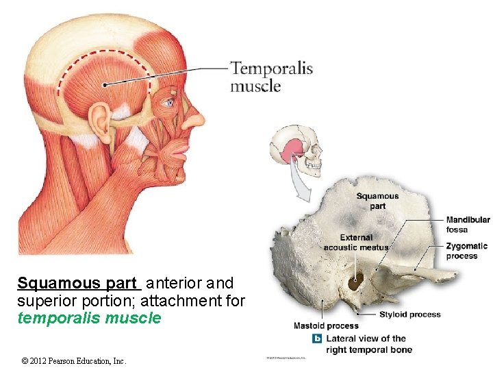 Squamous part anterior and superior portion; attachment for temporalis muscle © 2012 Pearson Education,