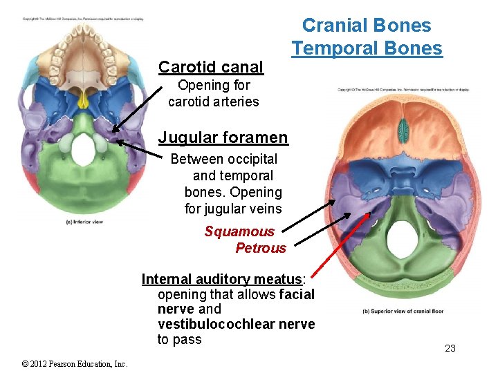 Carotid canal Cranial Bones Temporal Bones Opening for carotid arteries Jugular foramen Between occipital