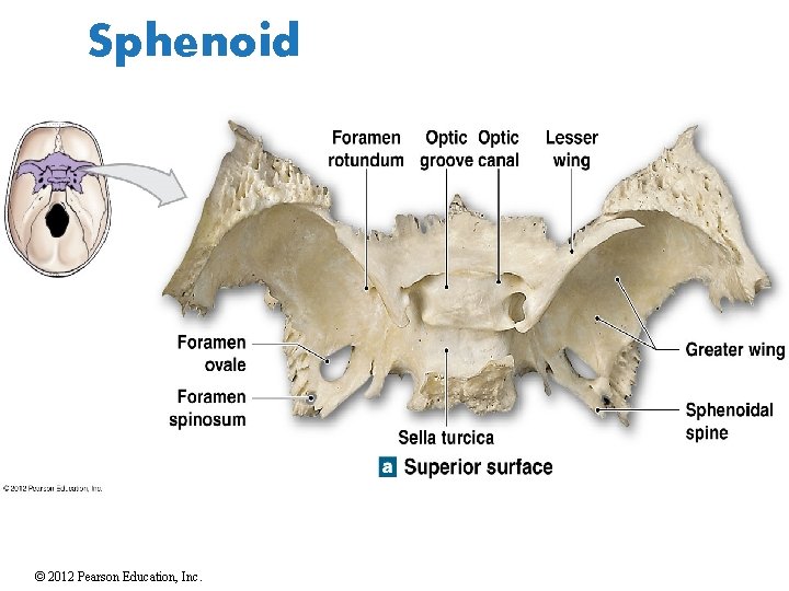 Sphenoid © 2012 Pearson Education, Inc. 