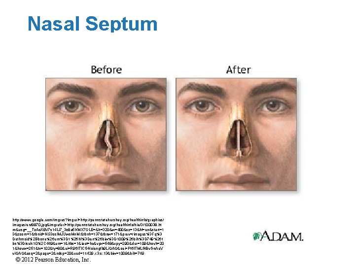 Nasal Septum http: //www. google. com/imgres? imgurl=http: //pennstatehershey. org/healthinfo/graphics/ images/en/8870. jpg&imgrefurl=http: //pennstatehershey. org/healthinfo/hie/3/100038. ht