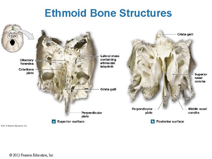 Ethmoid Bone Structures © 2012 Pearson Education, Inc. 