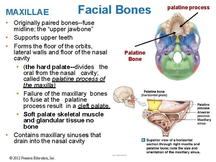 MAXILLAE Facial Bones • Originally paired bones--fuse midline; the “upper jawbone” • Supports upper