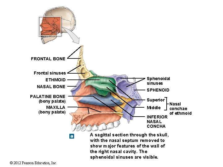 FRONTAL BONE Frontal sinuses ETHMOID NASAL BONE PALATINE BONE (bony palate) MAXILLA (bony palate)