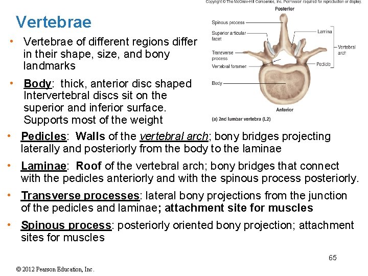 Vertebrae • Vertebrae of different regions differ in their shape, size, and bony landmarks