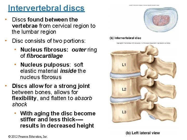 Intervertebral discs • Discs found between the vertebrae from cervical region to the lumbar