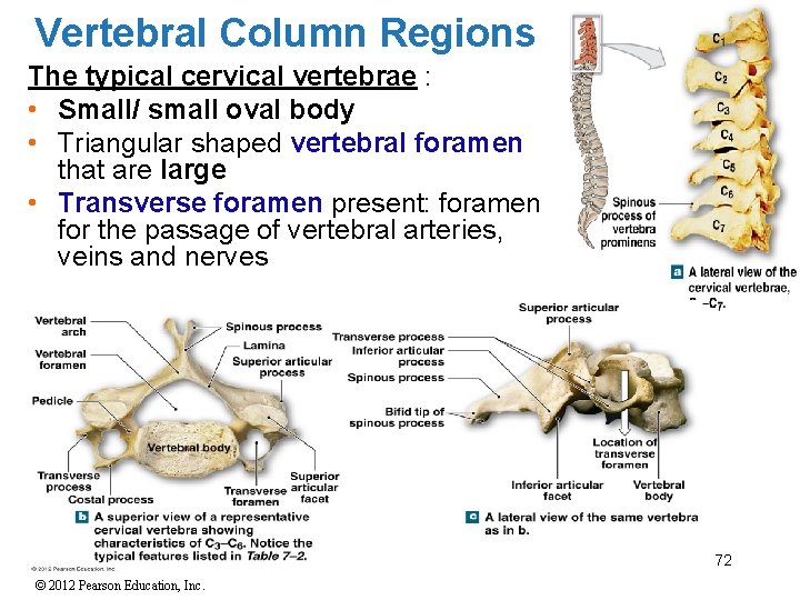 Vertebral Column Regions The typical cervical vertebrae : • Small/ small oval body •