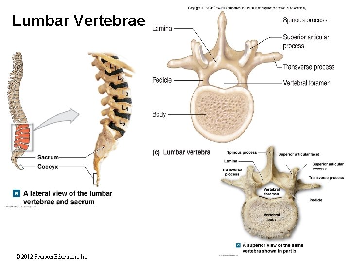 Lumbar Vertebrae © 2012 Pearson Education, Inc. 