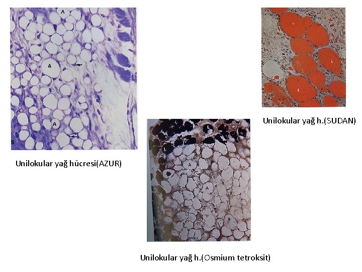 Unilokular yağ h. (SUDAN) Unilokular yağ hücresi(AZUR) Unilokular yağ h. (Osmium tetroksit) 