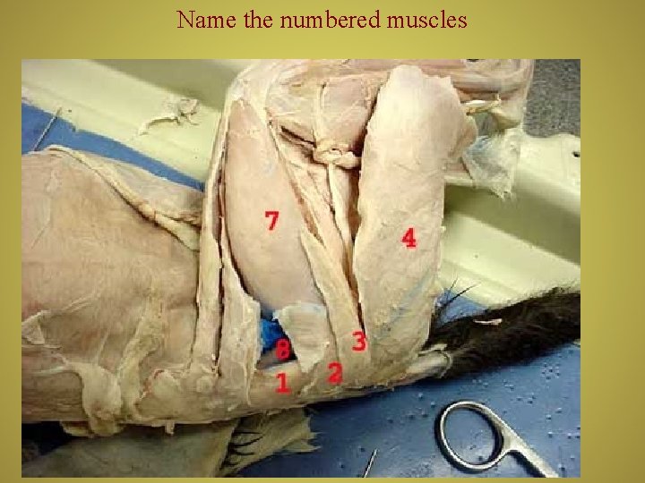 Name the numbered muscles 