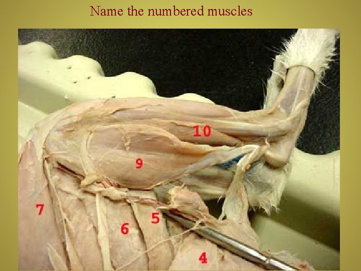 Name the numbered muscles 