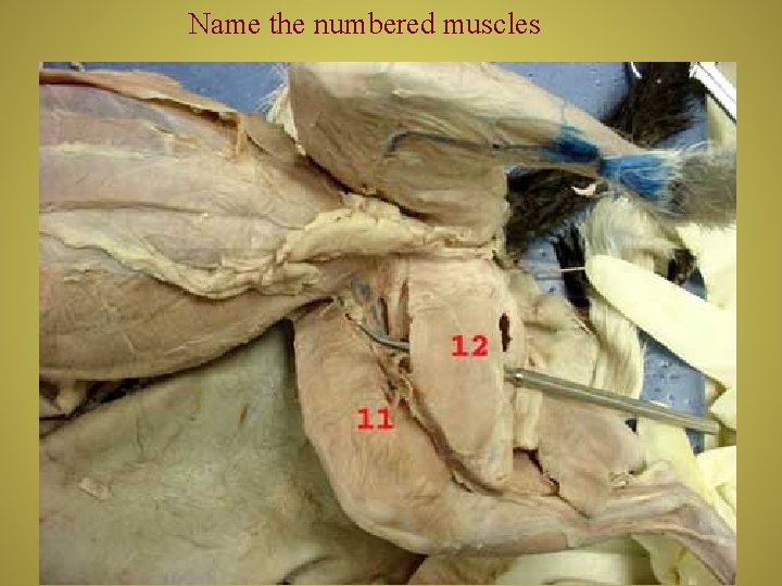 Name the numbered muscles 