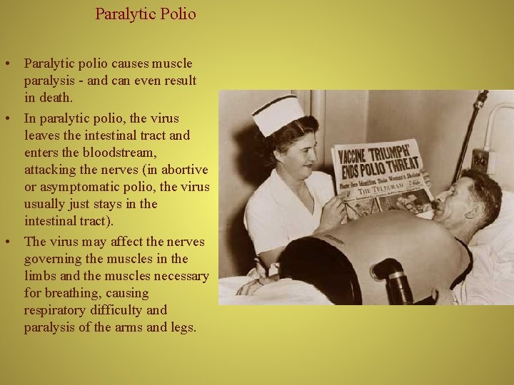 Paralytic Polio • Paralytic polio causes muscle paralysis - and can even result in