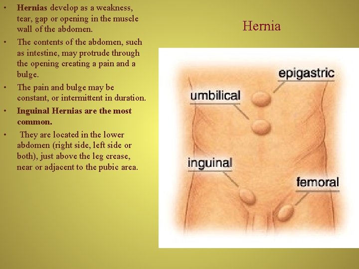  • • • Hernias develop as a weakness, tear, gap or opening in