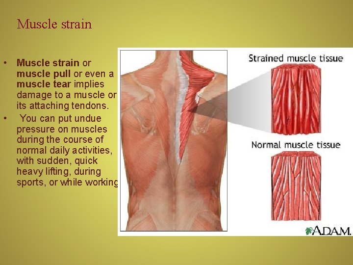 Muscle strain • Muscle strain or muscle pull or even a muscle tear implies