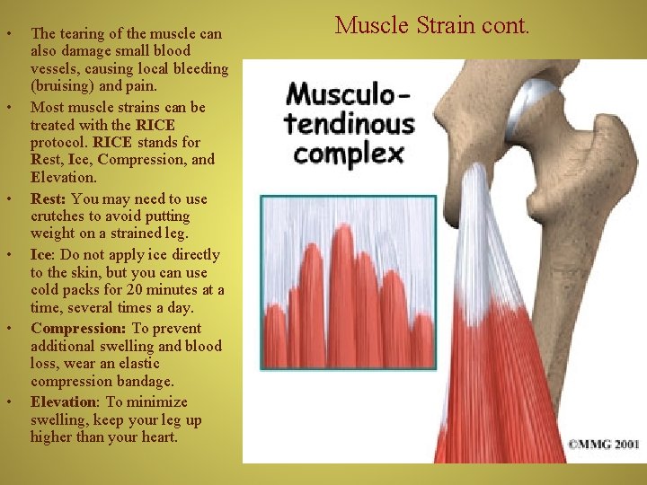  • • • The tearing of the muscle can also damage small blood