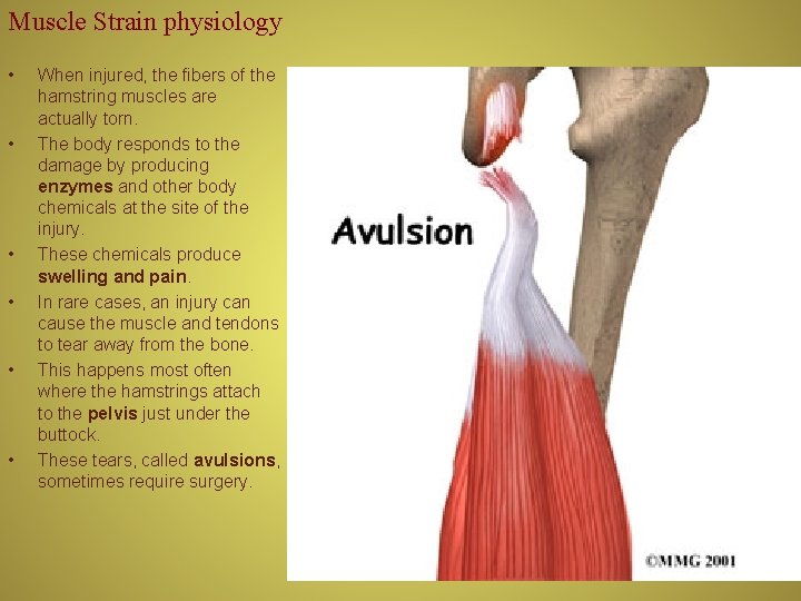 Muscle Strain physiology • • • When injured, the fibers of the hamstring muscles