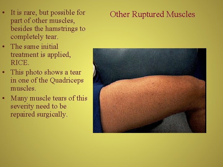  • It is rare, but possible for part of other muscles, besides the