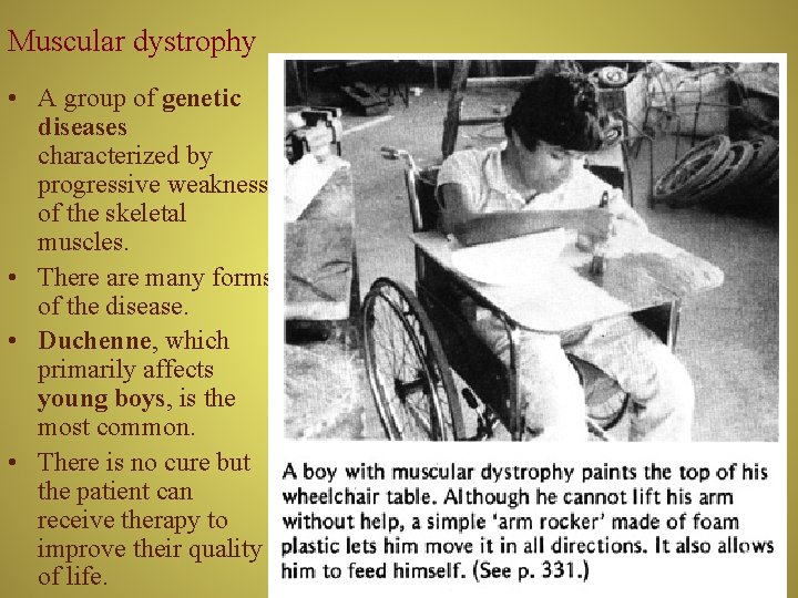 Muscular dystrophy • A group of genetic diseases characterized by progressive weakness of the