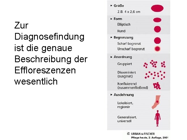 Zur Diagnosefindung ist die genaue Beschreibung der Effloreszenzen wesentlich Zur Diagnosefindung ist die genaue Beschreibung der Effloreszenzen wesentlich