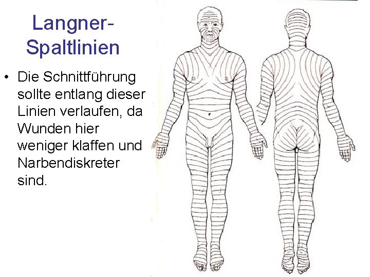Langner. Spaltlinien • Die Schnittführung sollte entlang dieser Linien verlaufen, da Wunden hier weniger Langner. Spaltlinien • Die Schnittführung sollte entlang dieser Linien verlaufen, da Wunden hier weniger