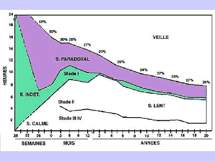 Mort Subite Du Nourrisson Et Troubles Du Sommeil