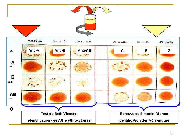 Anti-A Anti-B Anti-AB A B O A B AB O Test de Beth-Vincent Epreuve