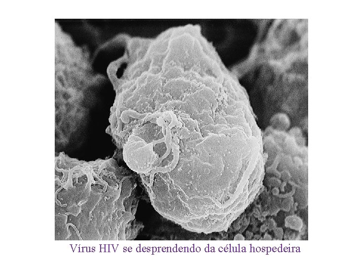 Vírus HIV se desprendendo da célula hospedeira 