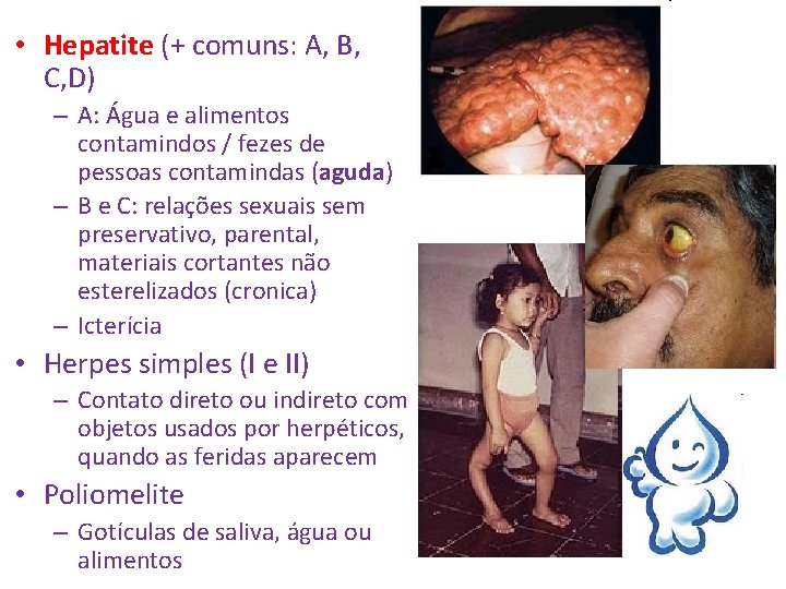  • Hepatite (+ comuns: A, B, C, D) – A: Água e alimentos