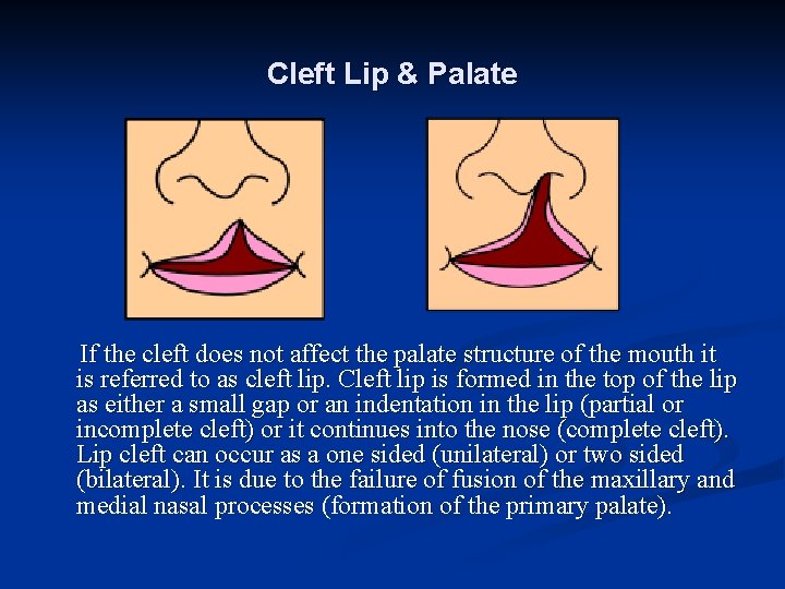 Cleft Lip & Palate If the cleft does not affect the palate structure of