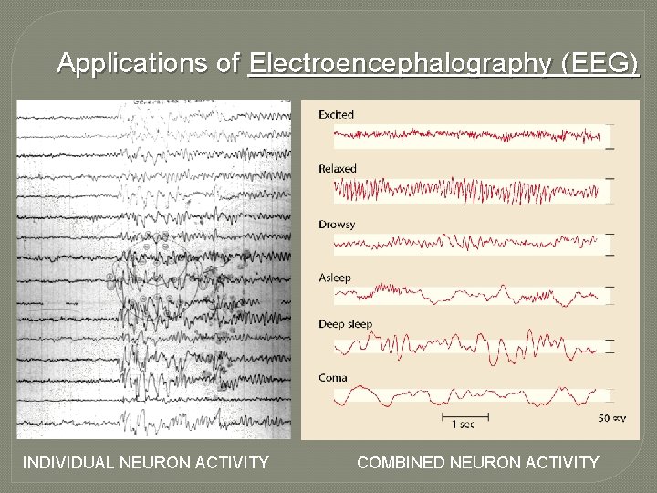 Applications of Electroencephalography (EEG) INDIVIDUAL NEURON ACTIVITY COMBINED NEURON ACTIVITY 