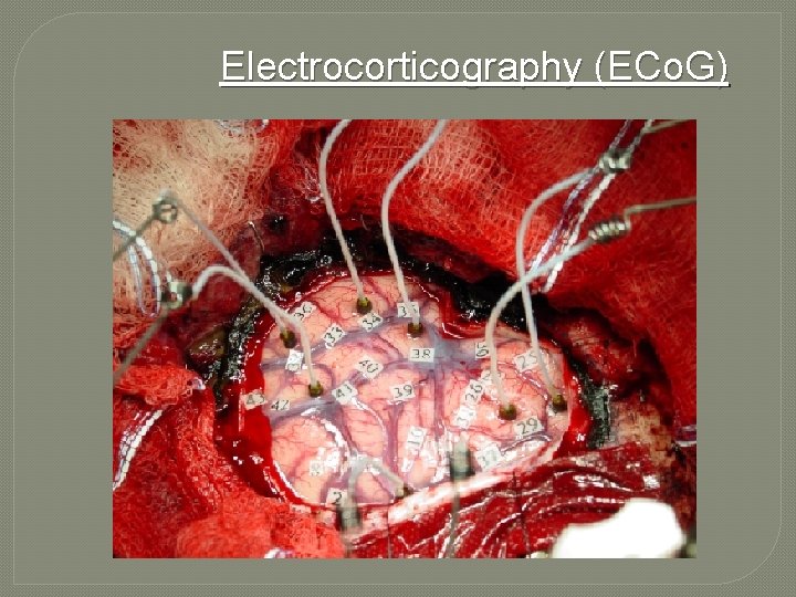 Electrocorticography (ECo. G) 