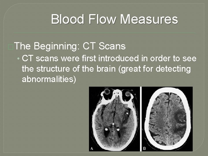 Blood Flow Measures �The Beginning: CT Scans • CT scans were first introduced in