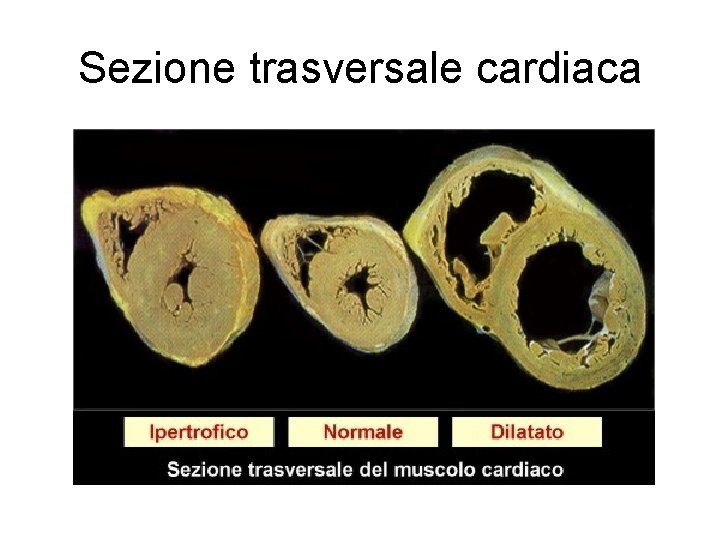 Sezione trasversale cardiaca 