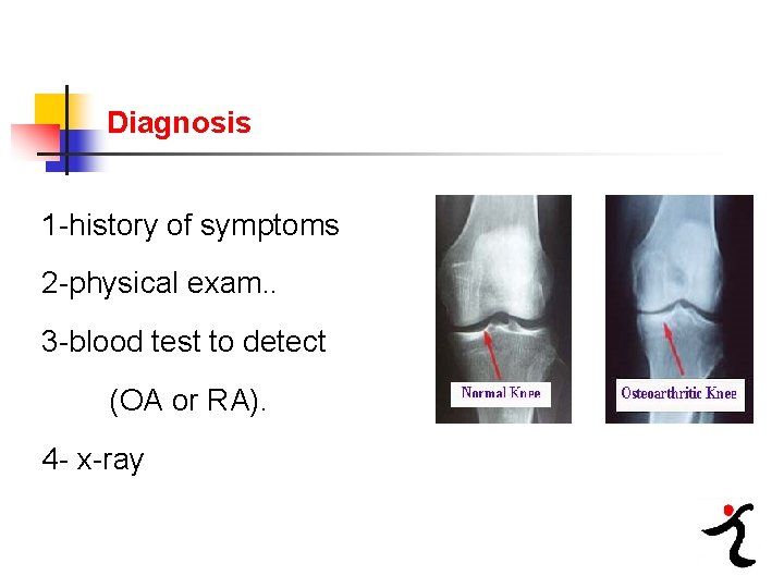 Diagnosis 1 history of symptoms 2 physical exam. . 3 blood test to detect