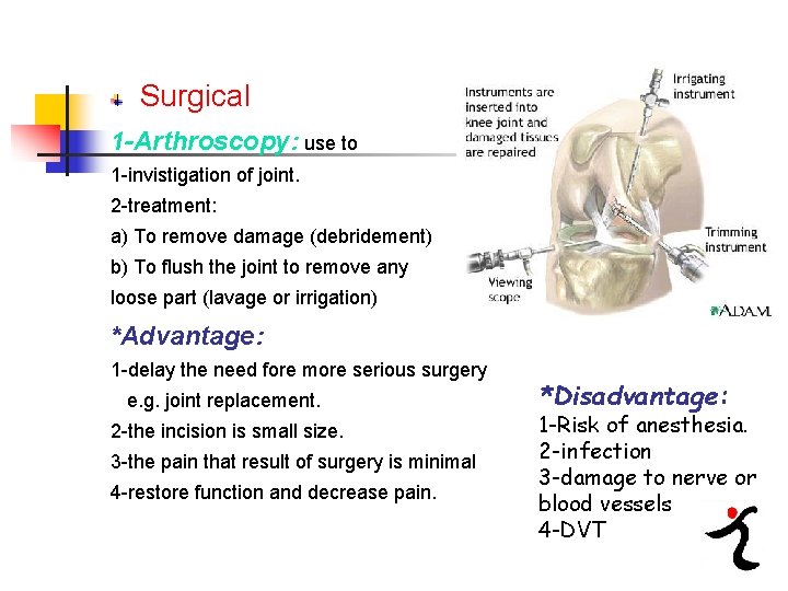 Surgical 1 -Arthroscopy: use to 1 invistigation of joint. 2 treatment: a) To remove