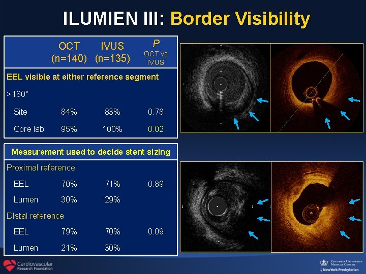 ILUMIEN III: Border Visibility OCT IVUS (n=140) (n=135) P OCT vs IVUS EEL visible