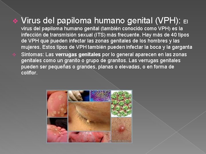 v Virus del papiloma humano genital (VPH): El virus del papiloma humano genital (también