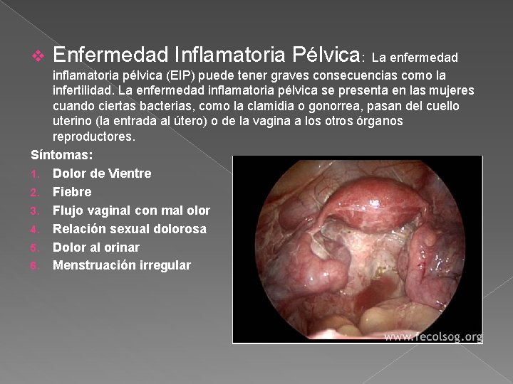 v Enfermedad Inflamatoria Pélvica: La enfermedad inflamatoria pélvica (EIP) puede tener graves consecuencias como