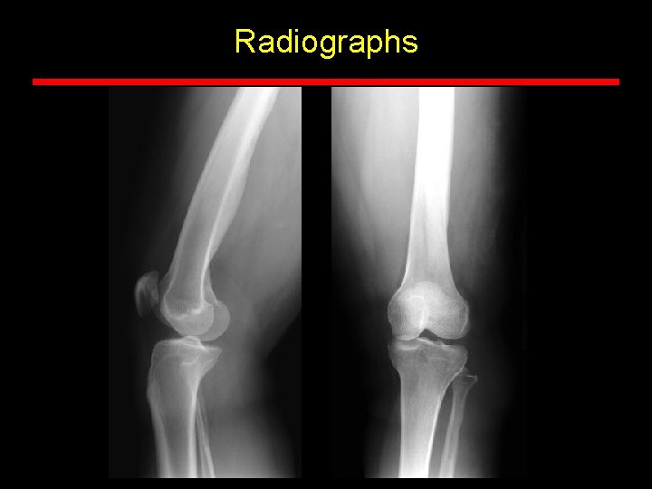 Radiographs Radiographs