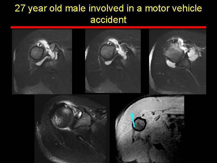 27 year old male involved in a motor vehicle accident 27 year old male involved in a motor vehicle accident