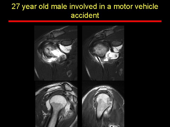 27 year old male involved in a motor vehicle accident 27 year old male involved in a motor vehicle accident