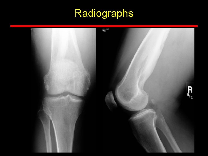 Radiographs Radiographs