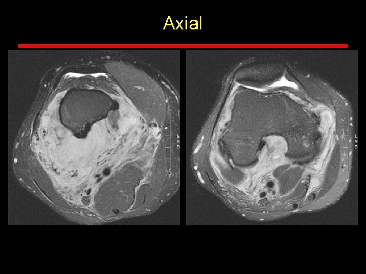 Axial Axial