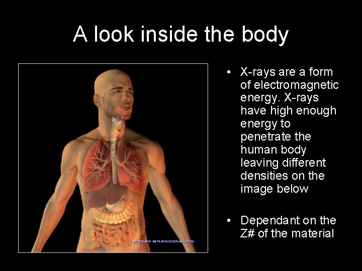 A look inside the body • X-rays are a form of electromagnetic energy. X-rays