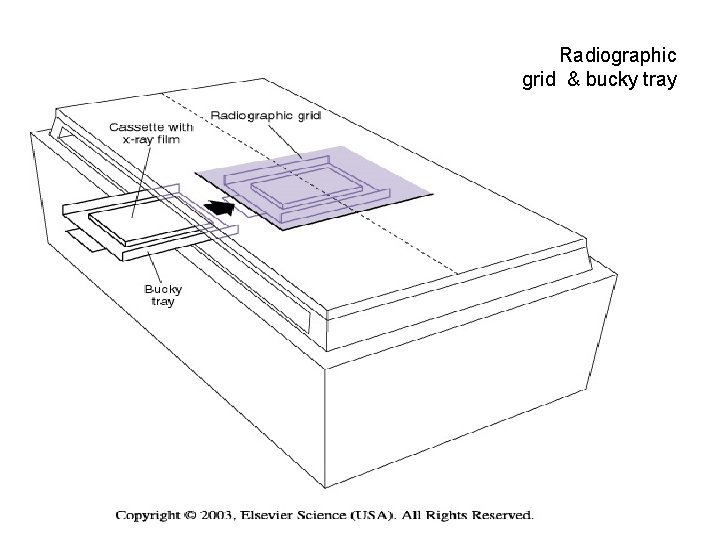 Radiographic grid & bucky tray 