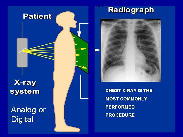 CHEST X-RAY IS THE MOST COMMONLY Analog or Digital PERFORMED PROCEDURE 
